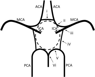 RNF213 p.R4810K (c.14429G > A) Variant Determines Anatomical Variations of the Circle of Willis in Cerebrovascular Disease